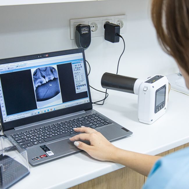 Medical professional analyzing dental X-ray on laptop in modern clinic. — Bakytzhan  Baurzhanov, Pexels