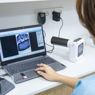Medical professional analyzing dental X-ray on laptop in modern clinic. — Bakytzhan  Baurzhanov, Pexels